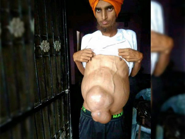 Pawandeep fighting with liver problem!