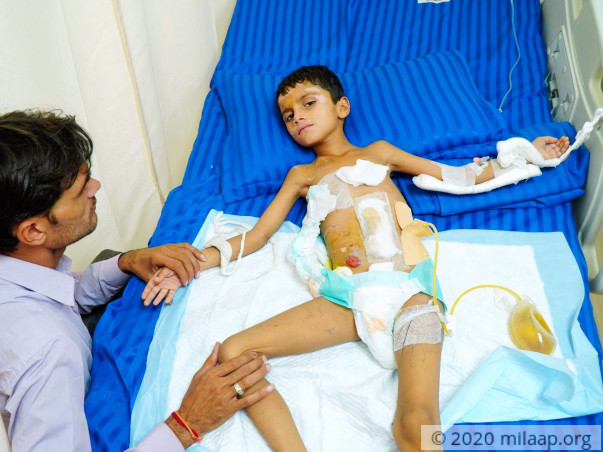 Help Dipanshu Recover From Traumatic Brain Injury