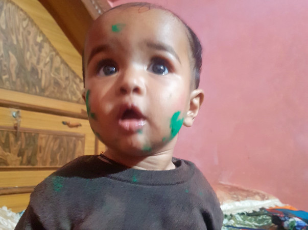 Help cute little child financial condition is not good