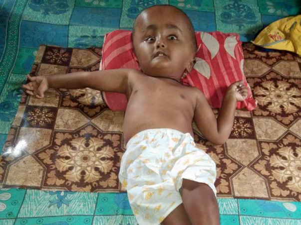 Help Aryan Fight Hydrocephalus