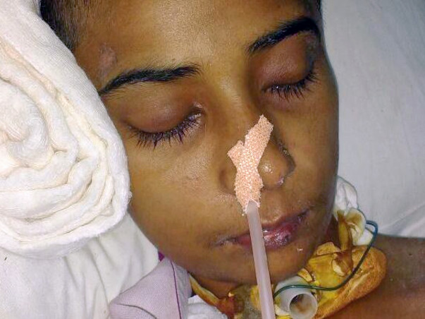 Save Priyanka's Life: Battling "Severe Brain Hemorrhage"