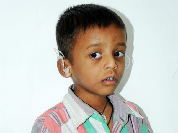 This Little Boy Has Not Heard Or Spoken A Word Since His Birth