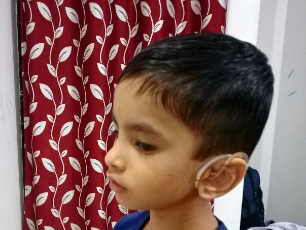 Help Shrijay Undergo Cochlear Implant Surgery