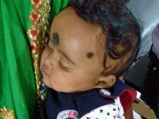 Help my five months nephew Abhisruti under go Liver Transplant.