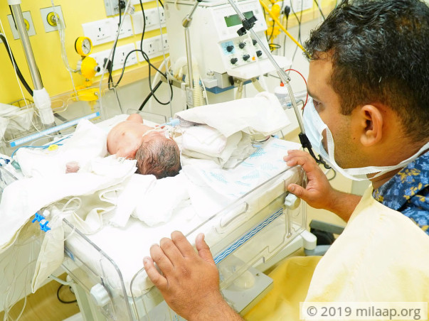 Baby of Pooja needs your help to survive