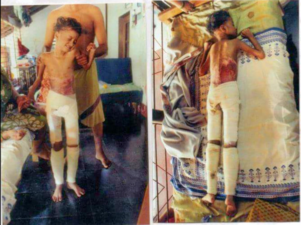 Help 10 year old Shreya to treatment