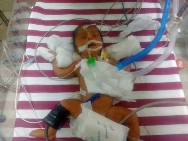 This Couple Needs Your Support To Save Their 3 Day-Old-Baby