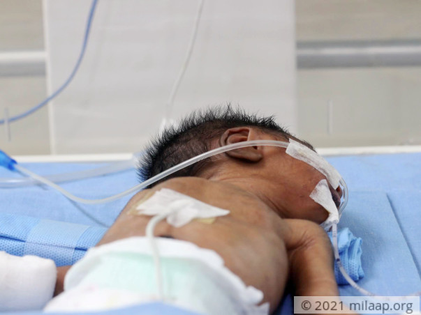 Help Baby of Saranya Recover