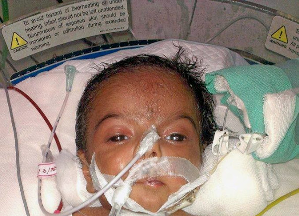 Help Me Save My 70 Day Old Son