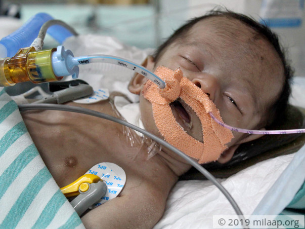 Labourer Will Lose Baby Girl To Multiple Organ Failure Without Help