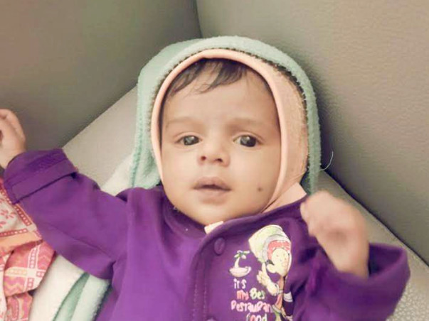 This 60-day-old baby needs an urgent surgery in the next 48 hours.