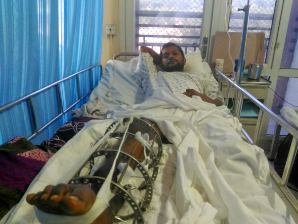 Cancer affected leg broken into pieces.