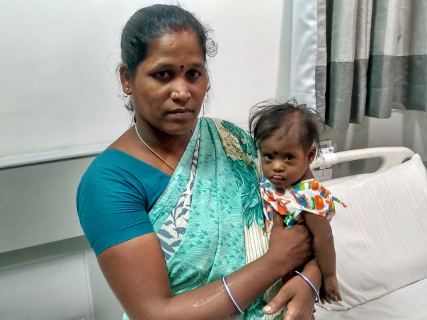 9-month-old With Down Syndrome Needs Urgent Heart Surgery