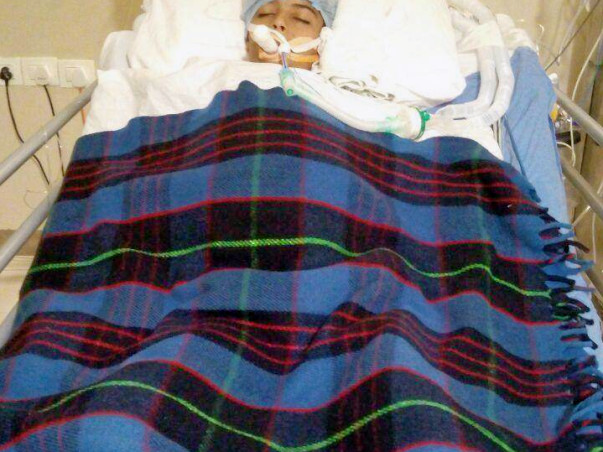 Aged13,M,is suffering from Budd Chiari syndrome