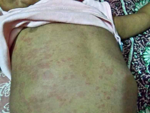 Ehan needs your help to undergo his treatment