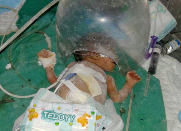 HELP PRITI'S TWIN BABIES