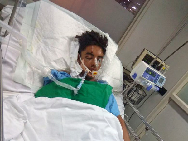 Help Sonali Save her Brother Who Met With A Tragic Road Accident