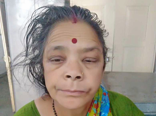 Help Bimla Undergo Heart And Kidney Treatment