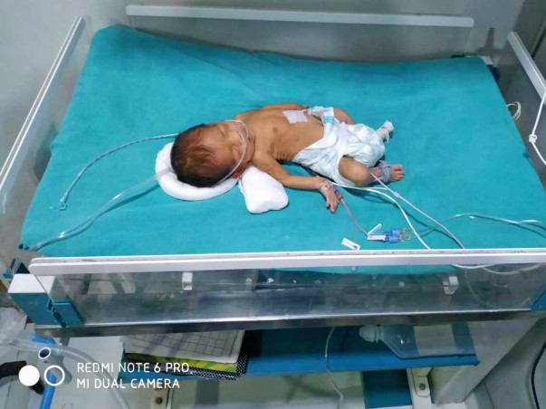 Jyoti's New Born Baby Fights For Each Breath