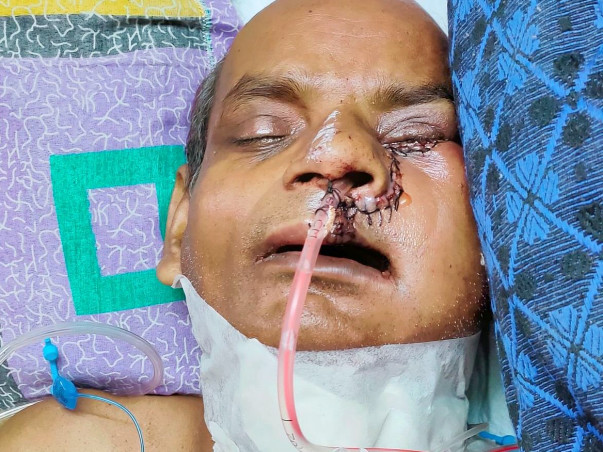 Support Sanamul Haque Recover From Mouth Cancer
