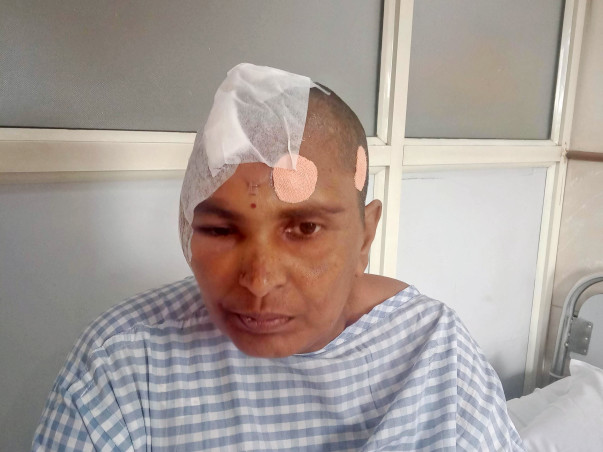 Help Latha Who's Fighting With Brain Tumour And Cancer