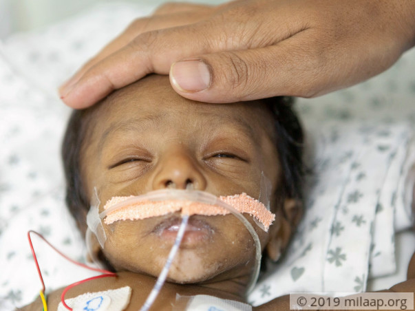 1-Month-Old Intestines Are Damaged Due To Milk Intolerance