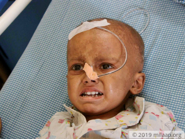 Akshar Patolla needs your help to undergo his treatment