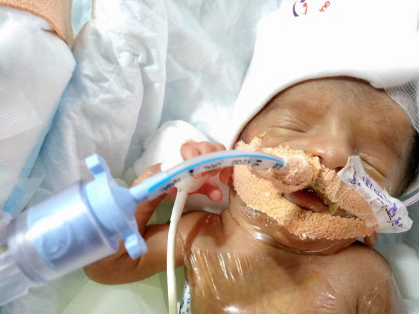 Help Stuti and Anurag save their premature baby boy