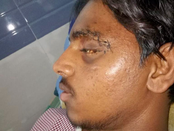 Help My Brother Recover From A Major Accident