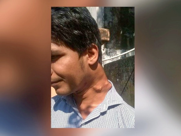 Save Rameez Khan From Paralysis