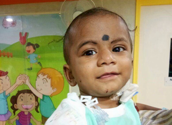 Help baby Likitesh undergo a liver transplant