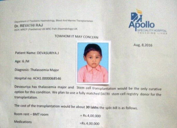 Child suffering from Thalassemia