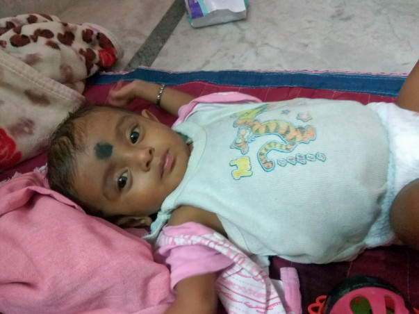 Born Preterm, Timely Treatment Can Still Save 6-month-old Baby Ganesh