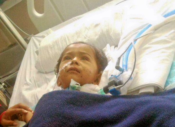 Help 15-Month-Old Mokshith Fight Pneumonia