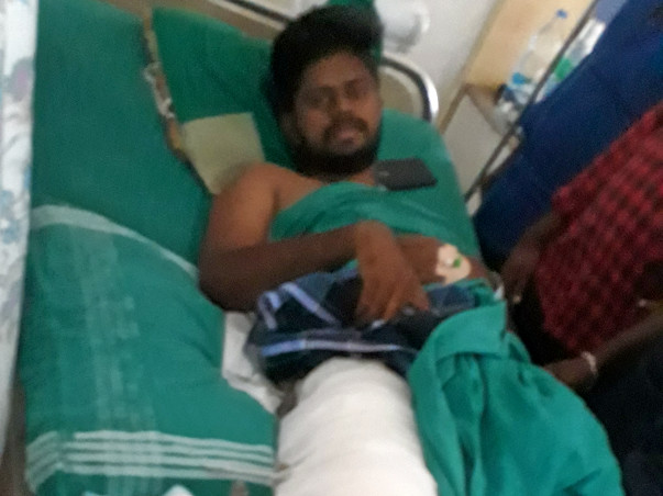 Poovendran leg fracture