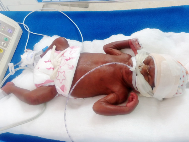 Help Ganesh To Save His 26-Week-Old Son