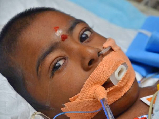 Help 7-year-old Barathraj fight for his life in the ICU