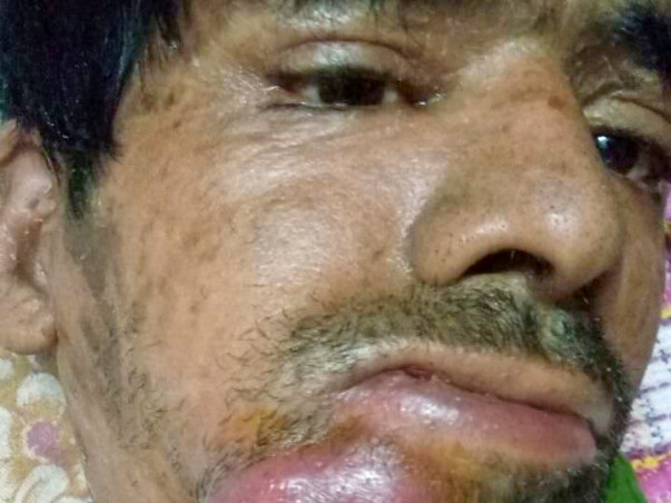 Help Sami Ulla Khan Fight Cancer