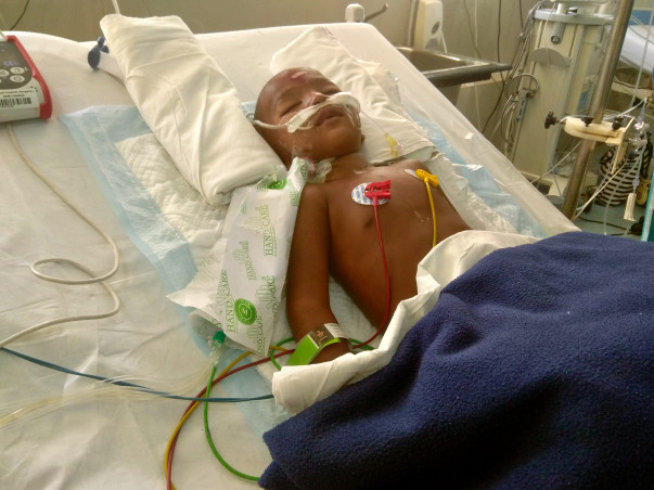 Help Jay Come Out Of Ventilator Support