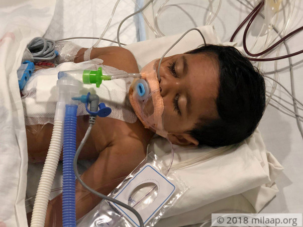 Help 1-year-old Pari fight a severe heart disease