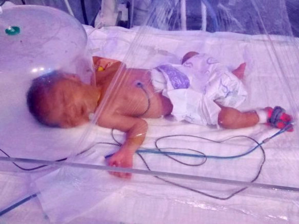 Save My 8-days-Old Premature Baby With Underdeveloped Organs