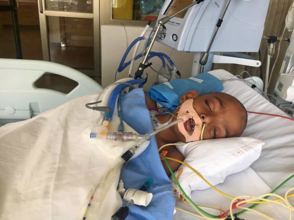 Help 4-year-old Neenu on life support fight severe Pneumonia