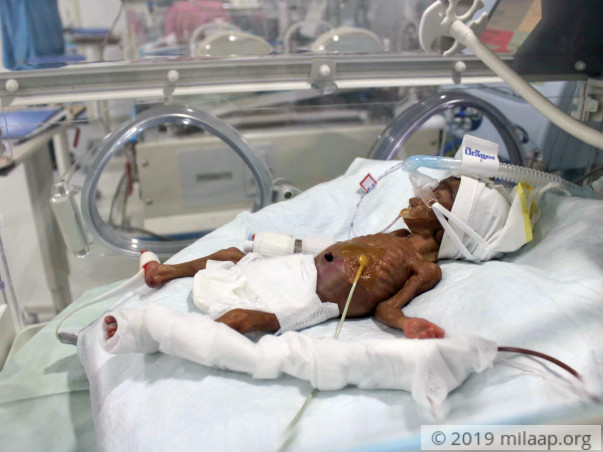 Help Baby of Pushpalatha Recover