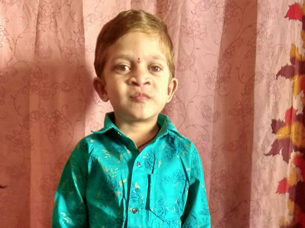 Help 6-Year-Old, Pavan From Rare Disease - Hermansky Pudlak Syndrome
