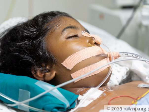 Help Vani Who Has A Multi Organ Failure