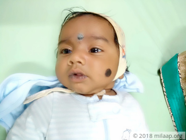 Priest Prays For Help To Fund Emergency Heart Surgery For 2-month-old
