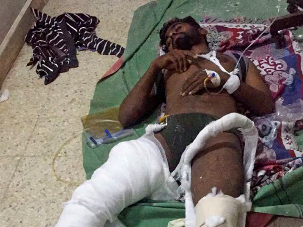 My close friend met with an accident, in a critical please help
