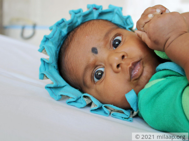 Only An Open Heart Surgery Will Save This 4-Month-Old's Life