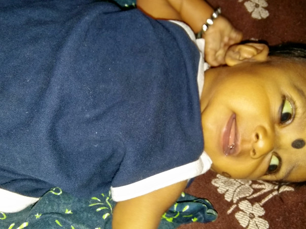 5-month old Baby Nainitha Needs To Undergo Liver Transplant