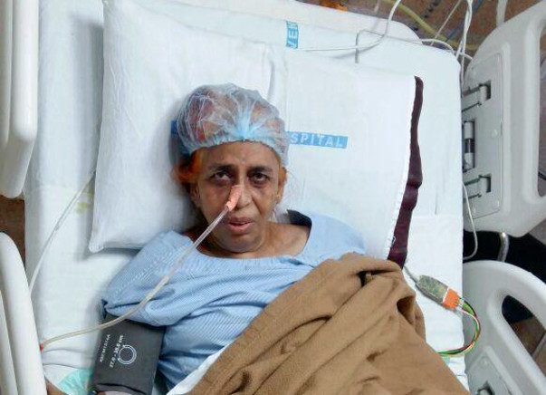 Help my mother for chemotherapy for colon cancer